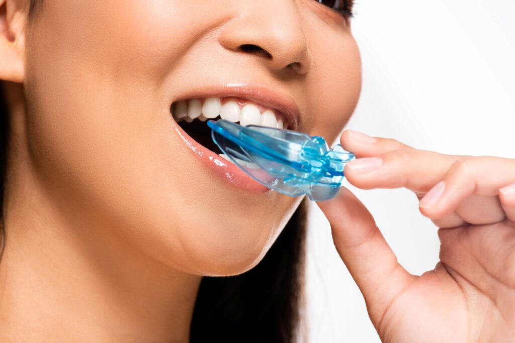 Woman inserting blue oral appliance